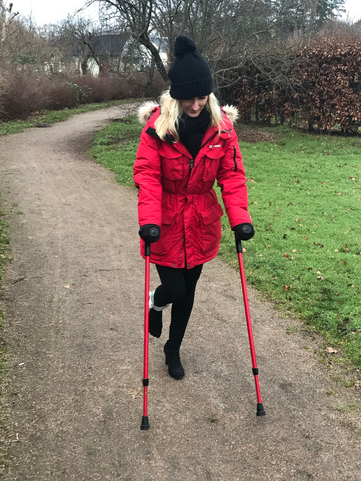 Stefanie 60 Aircast I think all can see my aircast t Crutchcast